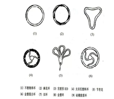 節育環有哪些類型 國內外節育環種類介紹