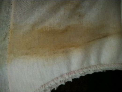 孕期內褲總是濕的怎么回事 孕期內褲濕是羊水嗎