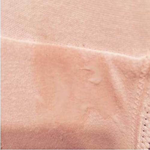 孕期內褲總是濕的怎么回事 孕期內褲濕是羊水嗎