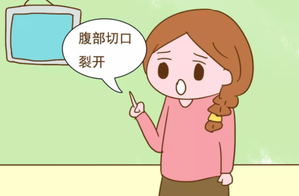 產(chǎn)后束腹帶有什么用 束縛帶的作用介紹