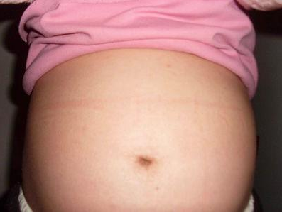 孕肚有的圓有的尖是怎么回事 孕肚看生男生女靠譜嗎