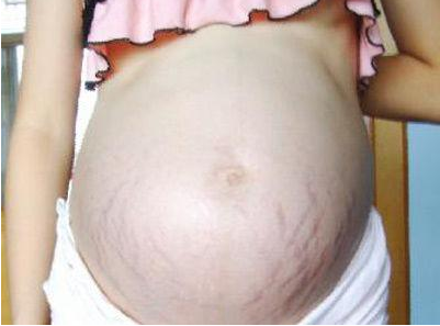 孕肚有的圓有的尖是怎么回事 孕肚看生男生女靠譜嗎