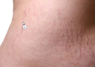 身體的哪些部位變黑說明胎兒正常 胎兒發育正常的表現 身體的哪些部位變黑說明胎兒正常 胎兒發育正常的表現