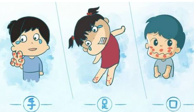 手足口病疾病有哪些臨床表現 如何預防手足口病