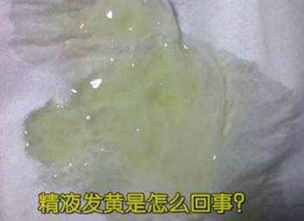 男性精液發(fā)黃正常嗎 男性精液發(fā)黃有什么危害 男性精液發(fā)黃正常嗎 男性精液發(fā)黃有什么危害