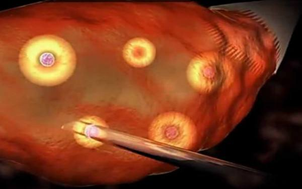 試管嬰兒取卵會導致卵巢早衰嗎 試管嬰兒取卵后怎么保養卵巢