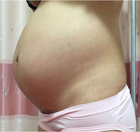 懷孕多久肚子會隆起 孕肚兩邊大小不一樣是怎么回事