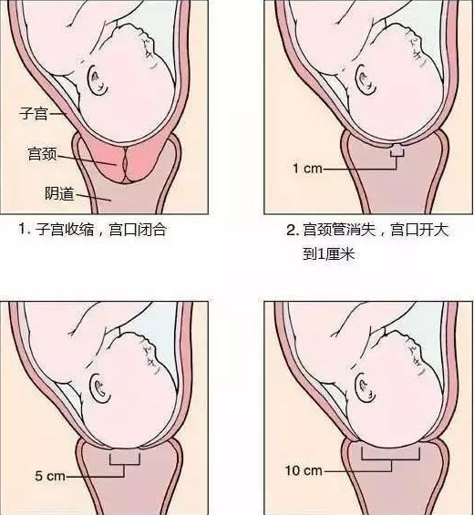 順產(chǎn)開(kāi)宮指是什么感覺(jué) 順產(chǎn)開(kāi)指過(guò)程