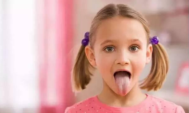 寶寶出現(xiàn)地圖舌是什么原因引起的 寶寶地圖舌怎么緩解