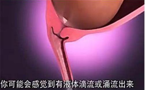 自然分娩全過(guò)程是怎么樣的 自然分娩過(guò)程圖解