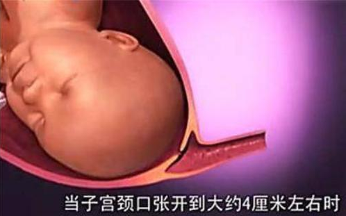自然分娩全過(guò)程是怎么樣的 自然分娩過(guò)程圖解