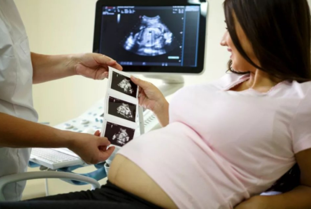 四維彩超什么時候做好 四維彩超怎么看