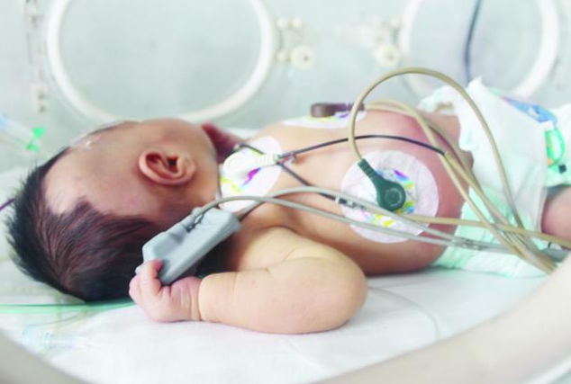 新生兒在什么情況下需要進保溫箱 嬰兒在保溫箱里要呆多久 新生兒在什么情況下需要進保溫箱 嬰兒在保溫箱里要呆多久