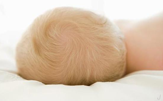 新生兒頭上結乳痂怎么回事 寶寶頭上乳痂怎么清理