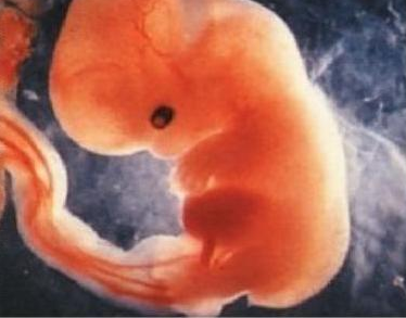 孕期羊水不足有什么表現 孕期羊水不足怎么辦