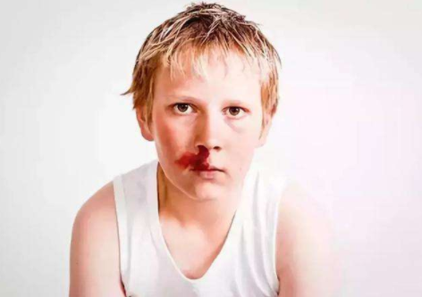 寶寶流鼻血可以仰頭嗎 寶寶流鼻血要不要仰頭