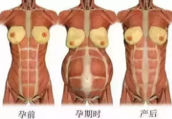 產后肚子大怎么恢復 產后肚子大恢復方法