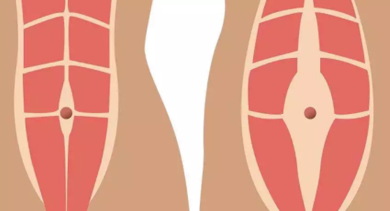 產后肚子大是怎么回事 產后肚子大的原因