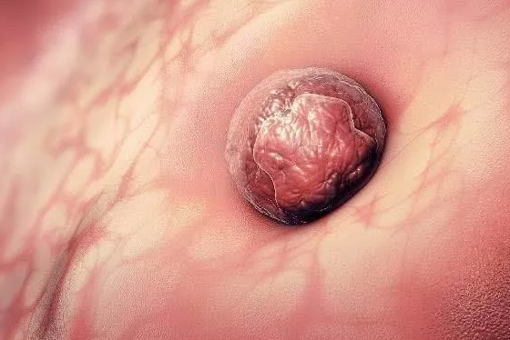 受精卵著床出血是怎么回事 受精卵著床出血的原因