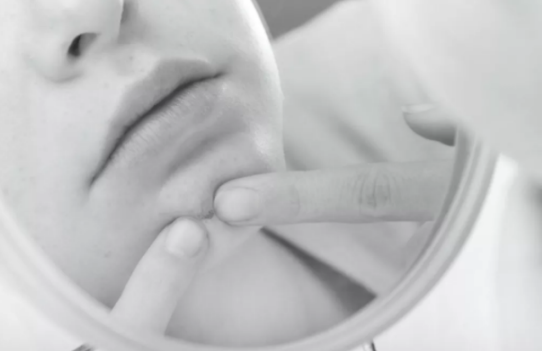 激素面膜有什么副作用 激素面膜的副作用