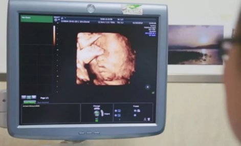 女兒借母親子宮生寶寶是怎么回事 女兒借母親子宮成功了嗎