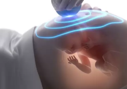 羊水偏少可以順產嗎 羊水偏少順產注意事項