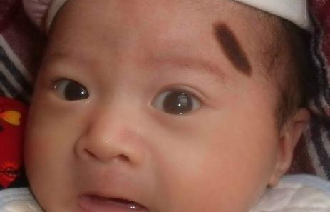 寶寶長胎記和媽媽有關(guān)系嗎 寶寶長胎記的影響因素