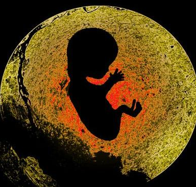 女性打引產針有哪些危害 女性引產后注意事項