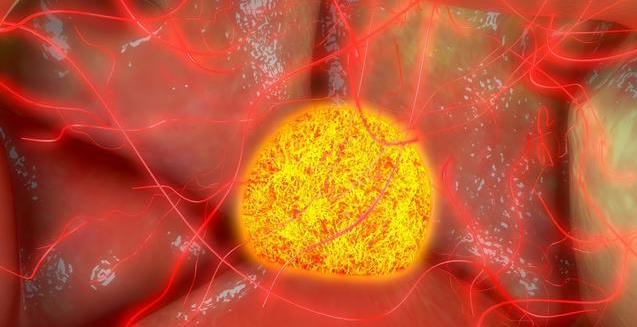 什么樣的卵泡是優質卵泡 提高卵子質量的方法