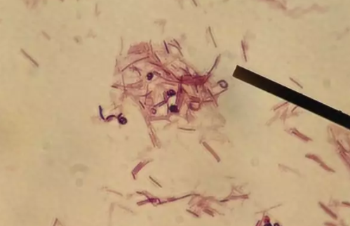 為什么寶寶吃點(diǎn)肉就便秘 春節(jié)寶寶便秘解決方法