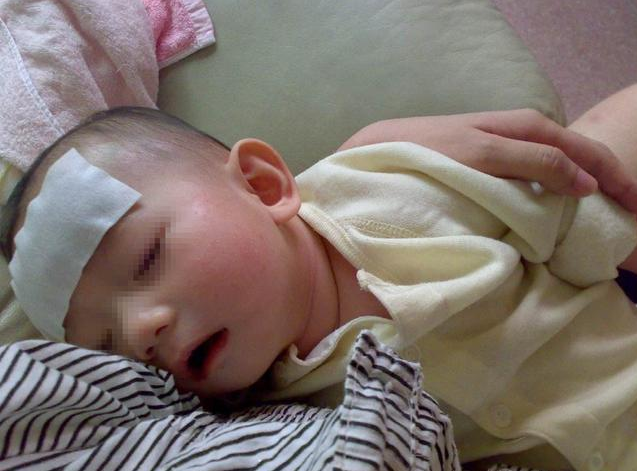 孩子發燒怎么退燒 孩子發燒什么時候要送醫院