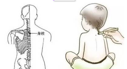 孩子臉色蠟黃怎么辦 寶寶臉色蠟黃調理方法