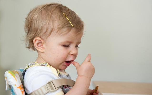 小兒手足口病嚴重嗎 小兒手足口病會引起哪些并發(fā)癥