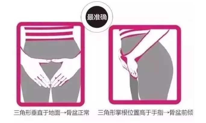 如何自測骨盆前傾 骨盆前傾怎么糾正 如何自測骨盆前傾 骨盆前傾怎么糾正