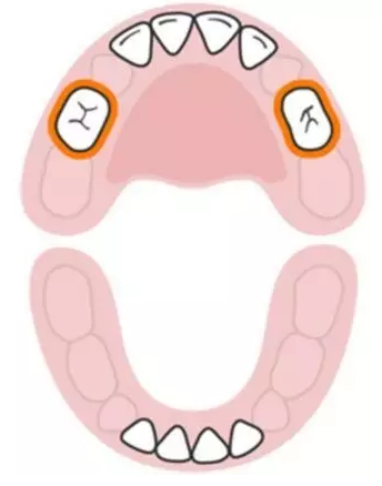 寶寶換牙時間表2019 兒童換牙時間順序 寶寶換牙時間表2019 兒童換牙時間順序