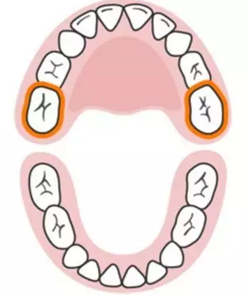 寶寶換牙時間表2019 兒童換牙時間順序 寶寶換牙時間表2019 兒童換牙時間順序