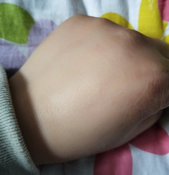 御方寶貝植物護臀膏油不油 御方寶貝植物護臀膏好不好