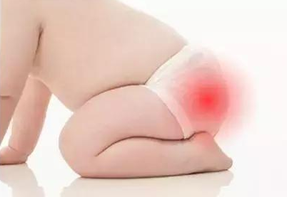 寶寶紙尿褲不透氣會紅屁股嗎 給寶寶穿紙尿褲注意事項