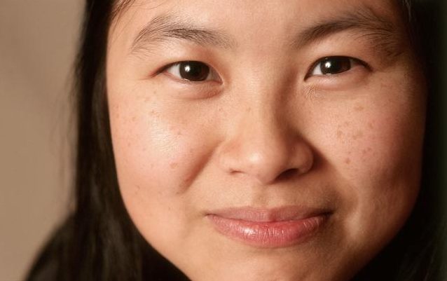 懷孕后皮膚變差的原因 懷孕后皮膚變差改善方法