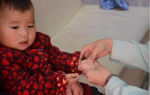 小兒推拿可以治病嗎 小兒推拿治病靠不靠譜