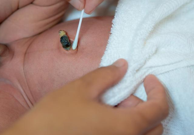 新生兒臍帶脫落多久可以碰水 新生兒臍帶護理注意事項