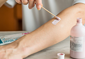 孩子是過敏體質的表現 怎么判斷孩子是過敏體質