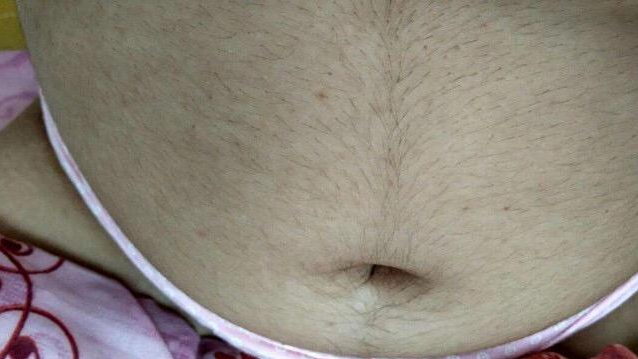 孕婦肚皮長毛和胎兒性別有關嗎 孕婦肚皮長毛是怎么回事