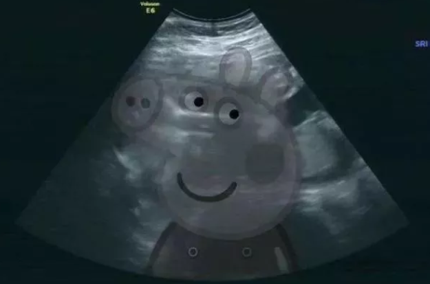 懷了豬寶寶開心的說說 2019懷豬寶寶的說說朋友圈