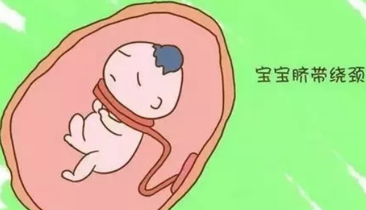 孕婦爬樓梯對寶寶有影響嗎 孕婦爬樓梯運動好不好