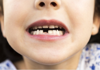 孩子牙沒刷好可能導致骨質疏松牙齒脫落 孩子如何正確的刷牙