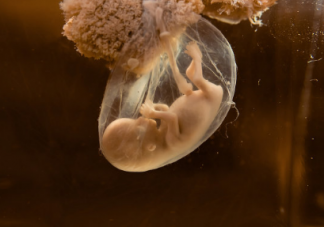 寶寶長期在養水里不會被淹死嗎  寶寶在羊水里不會缺氧嗎