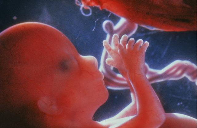 孕婦羊水渾濁一般發生在什么時候 孕婦羊水渾濁的原因