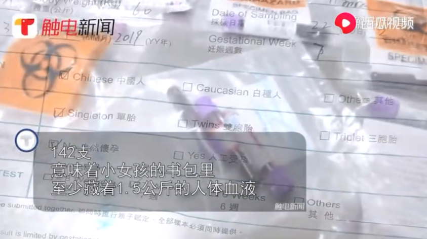 12歲女童書包攜帶142支孕婦血樣被截 孕婦血樣驗子靠譜嗎