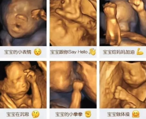 做四維寶寶不配合怎么辦 做四維胎兒不配合的原因